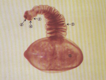 囊虫装片